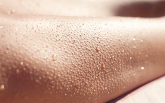 Goosebumps in the hot sauna: the unexpected phenomenon explained