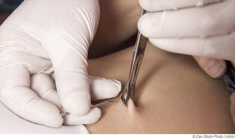 Mit Piercing in die Sauna