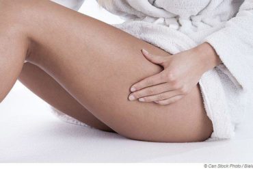 Sauna and cellulite - What helps against orange peel skin